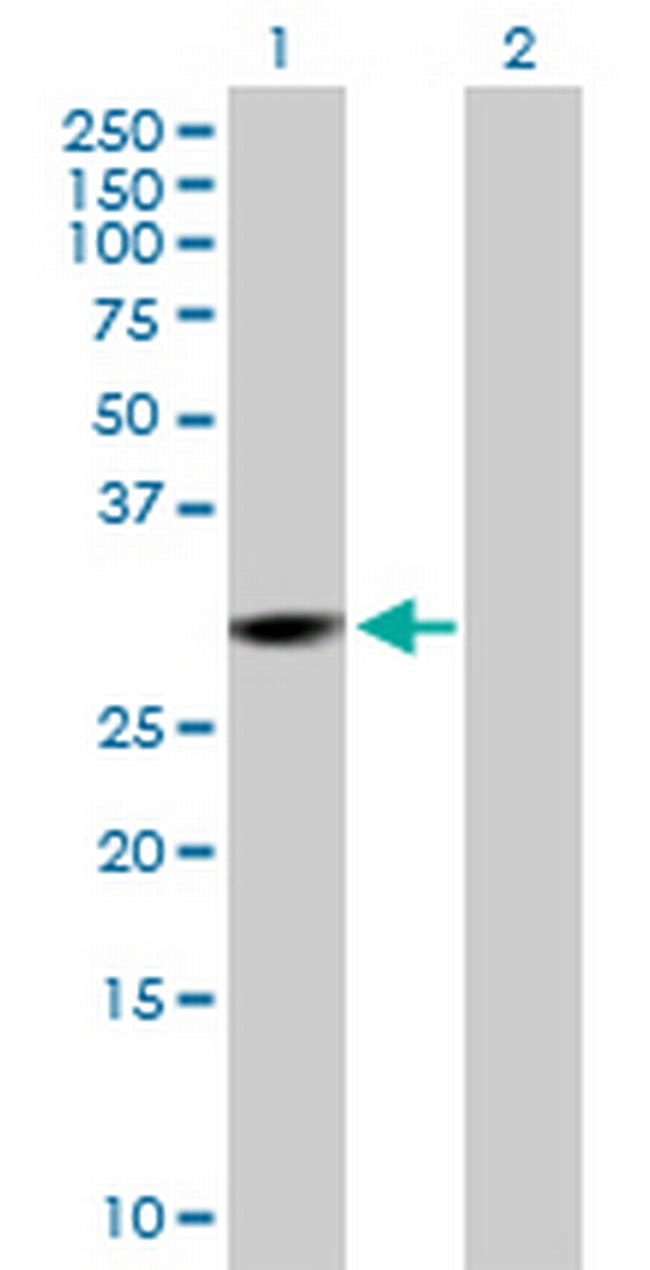 CMBL Antibody in Western Blot (WB)