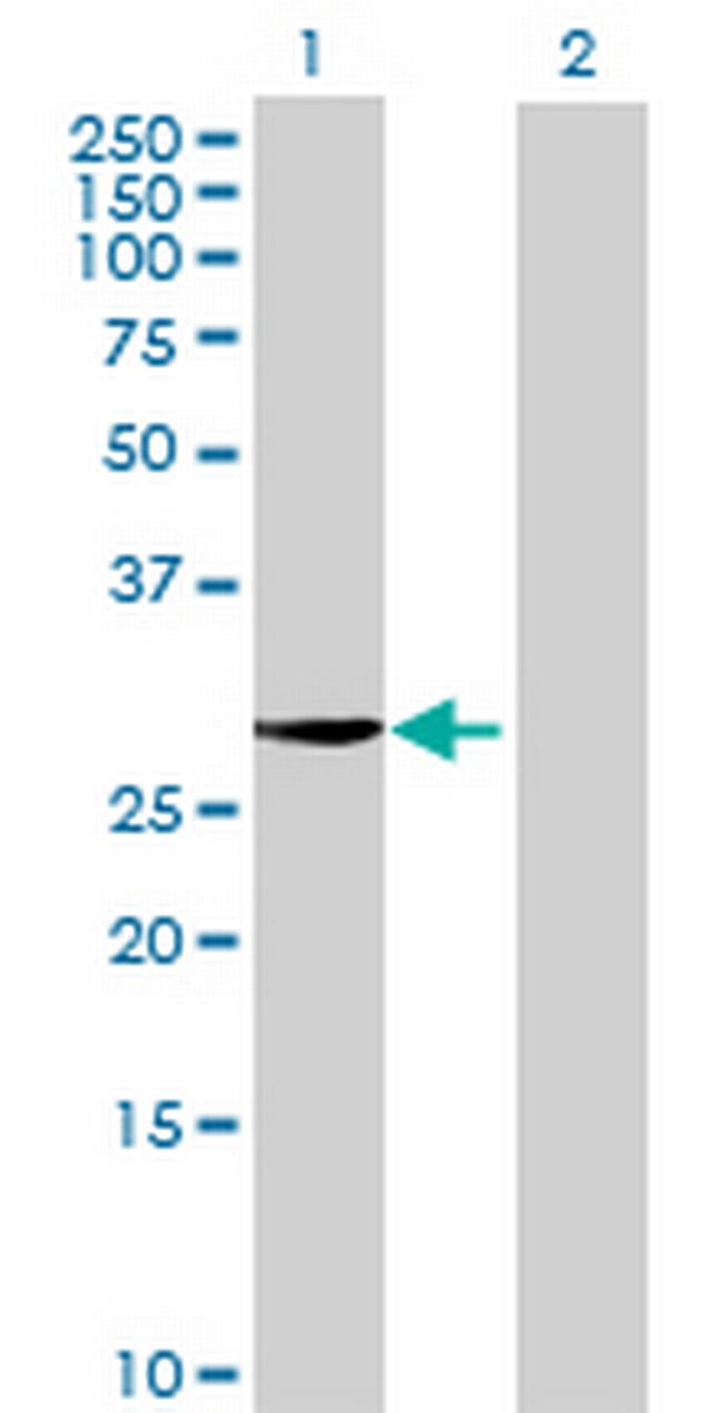 PACRG Antibody in Western Blot (WB)