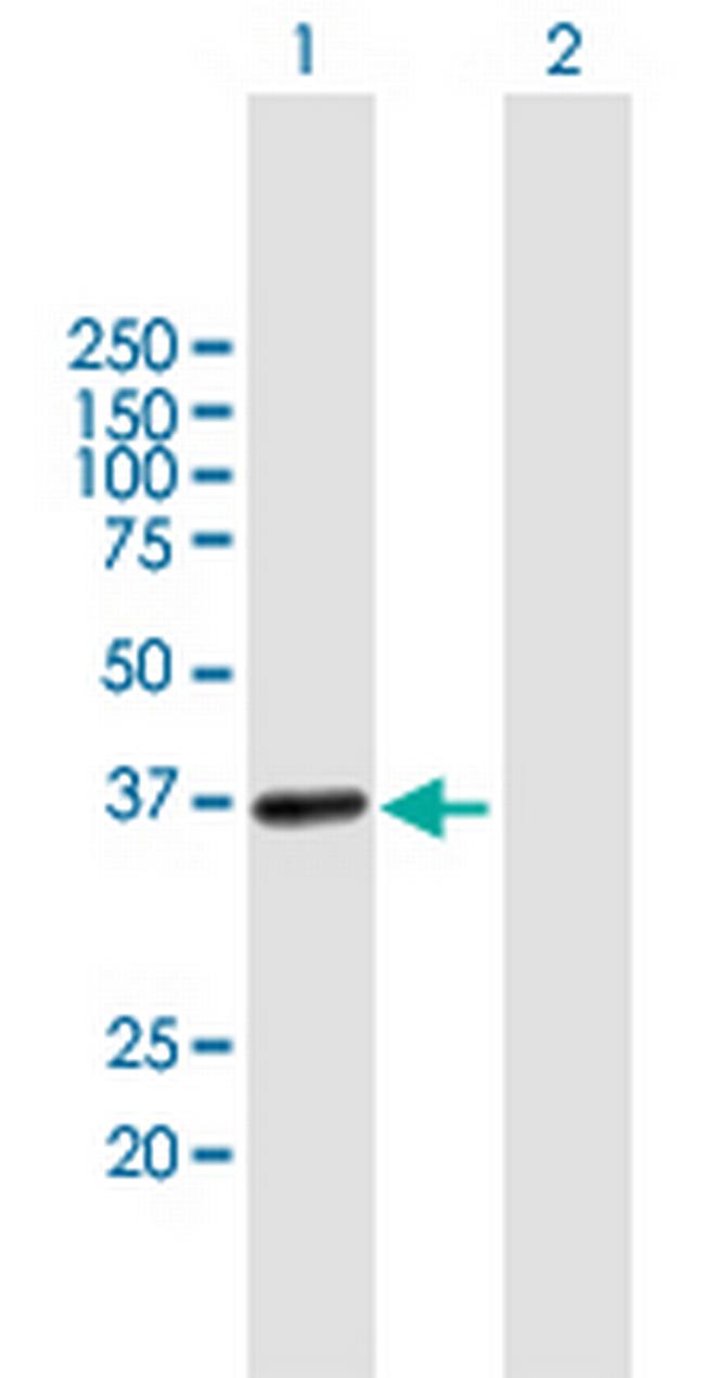 UPRT Antibody in Western Blot (WB)