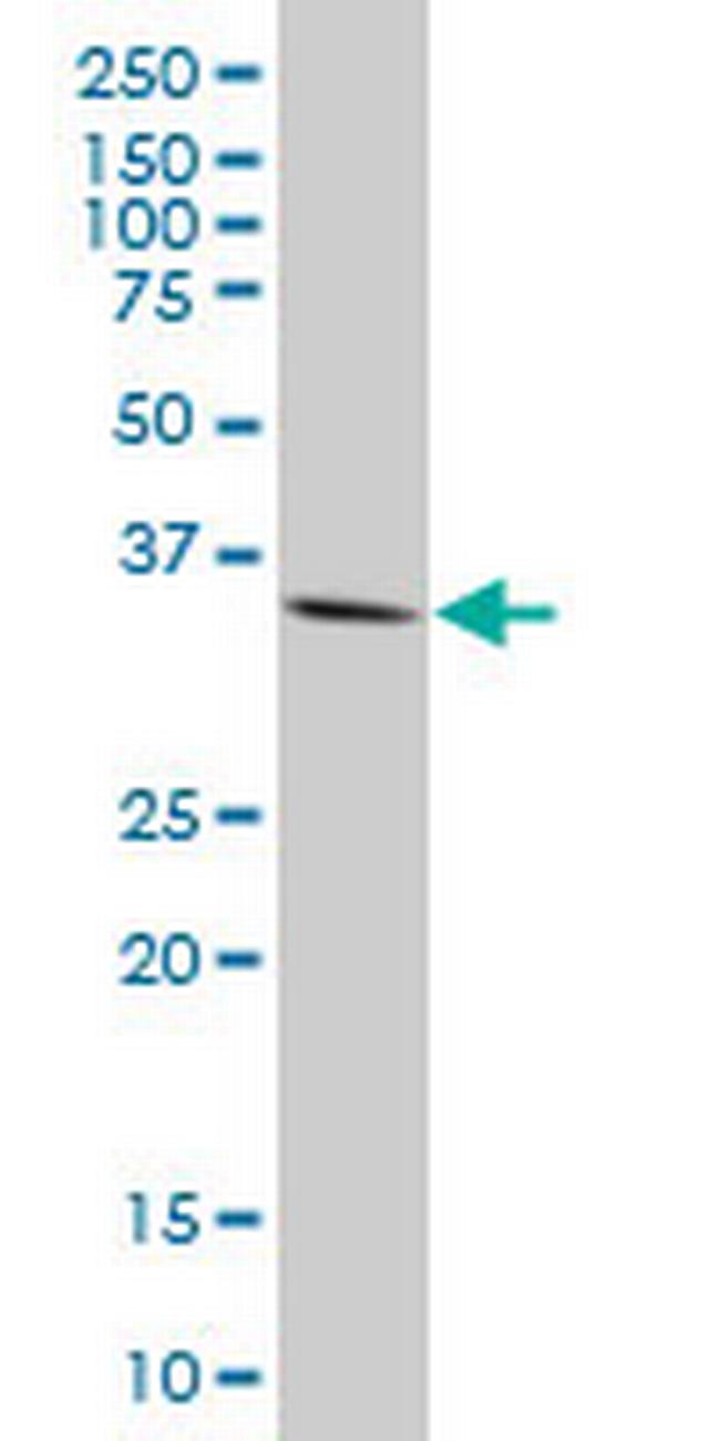 GSC Antibody in Western Blot (WB)