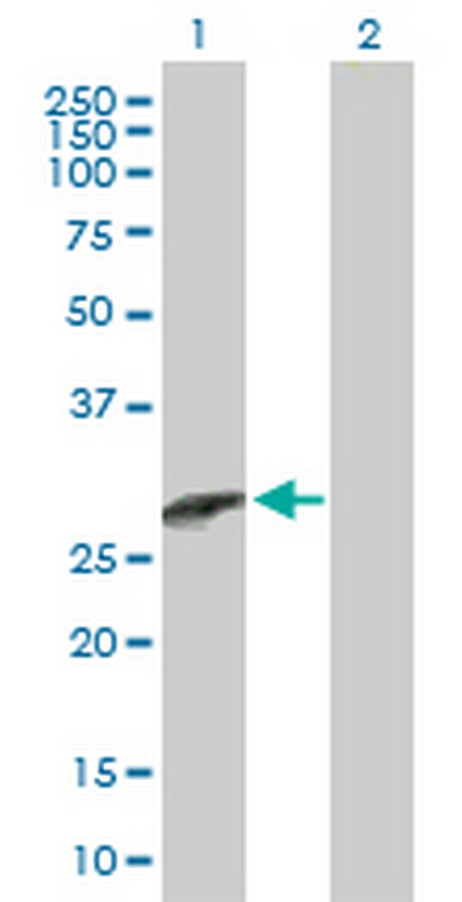 CCBE1 Antibody in Western Blot (WB)