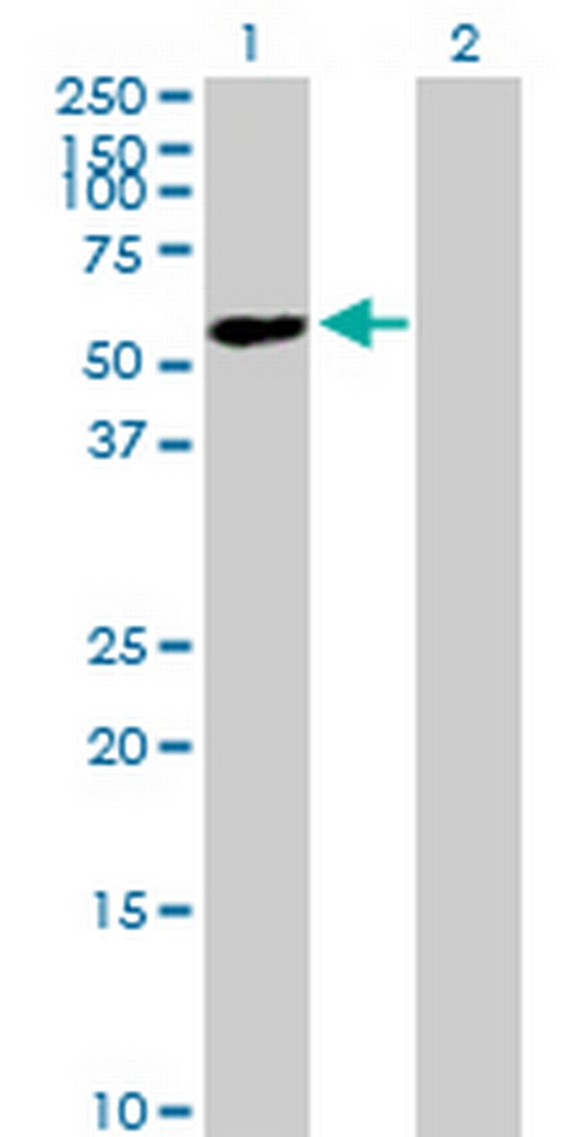 ZNF565 Antibody in Western Blot (WB)