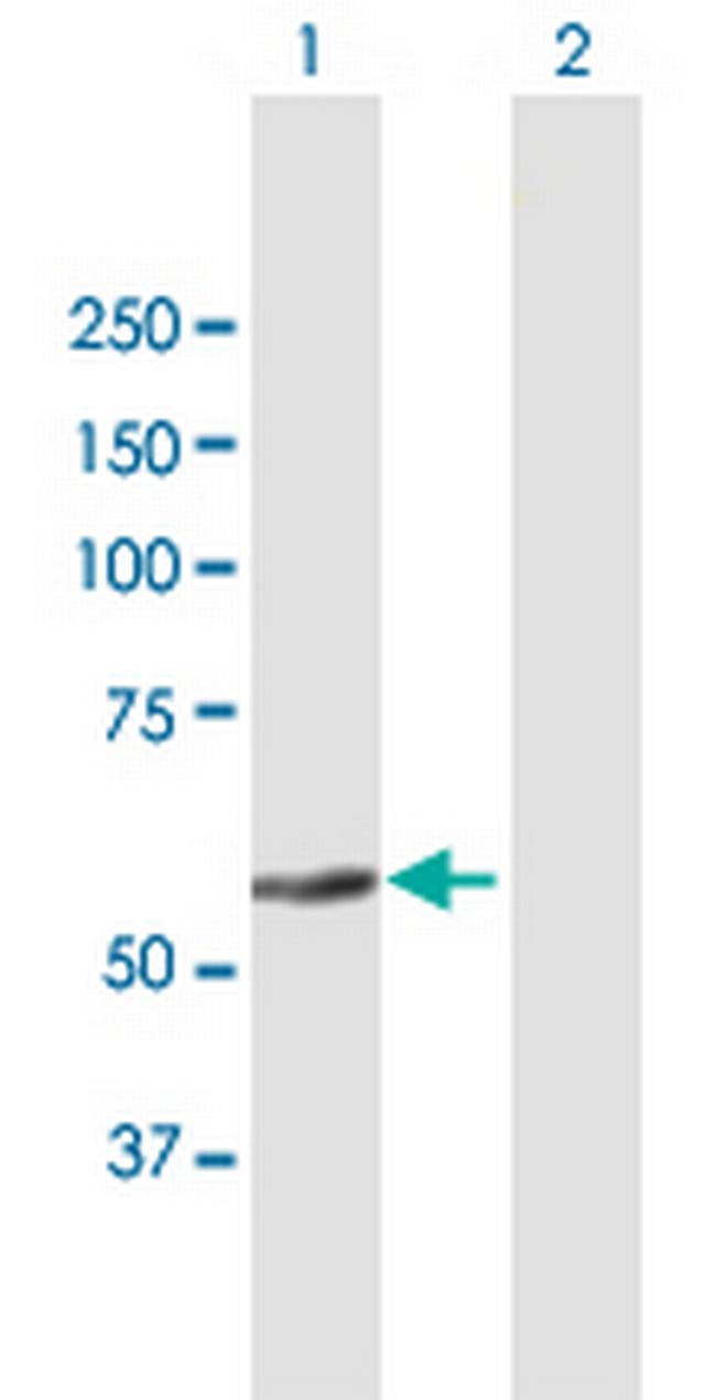 ZNF582 Antibody in Western Blot (WB)