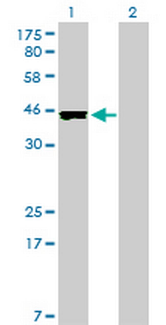 CREB3L4 Antibody in Western Blot (WB)