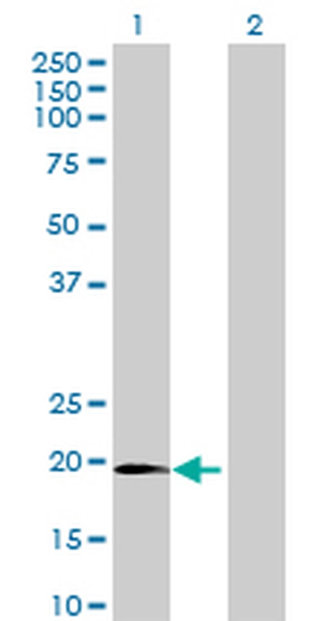 C1ORF84 Antibody in Western Blot (WB)