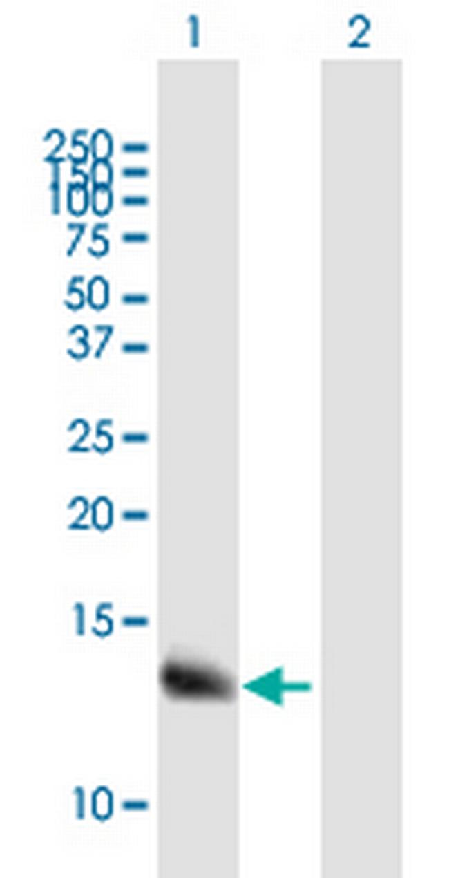 WFDC5 Antibody in Western Blot (WB)