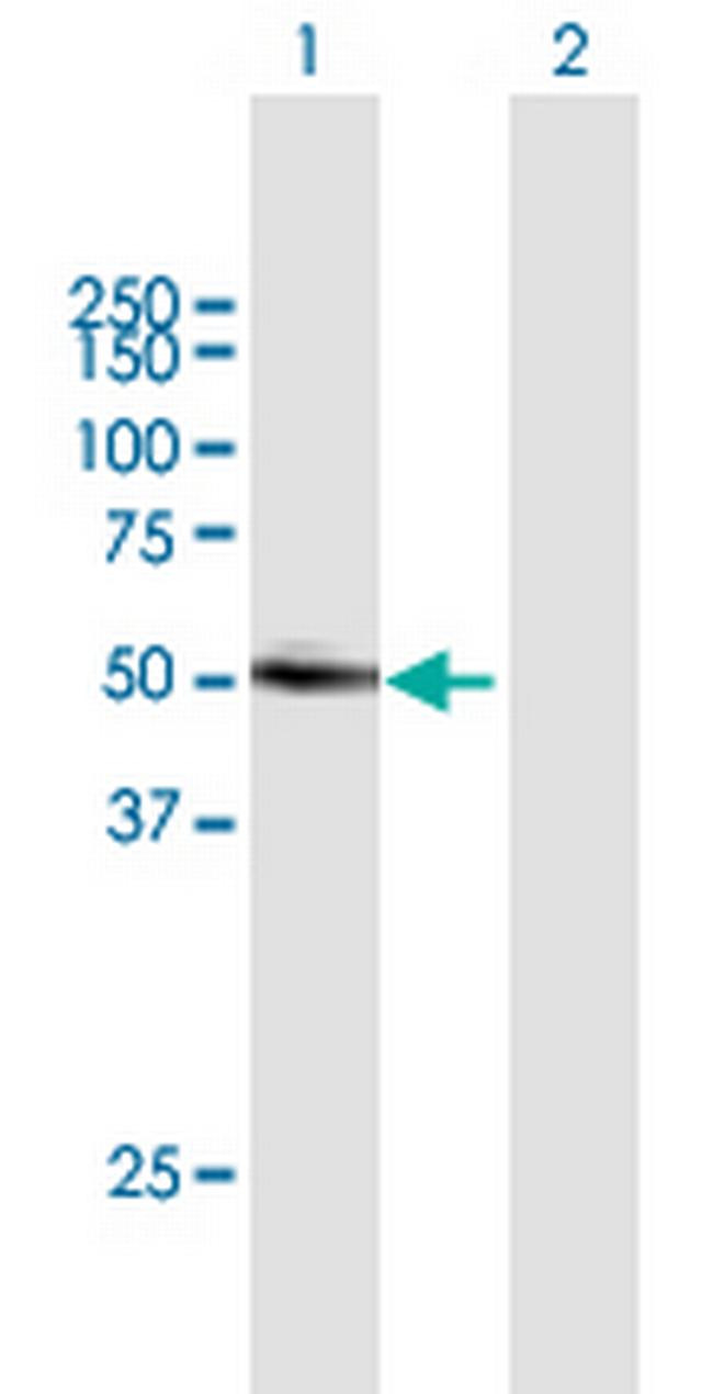 LIPI Antibody in Western Blot (WB)