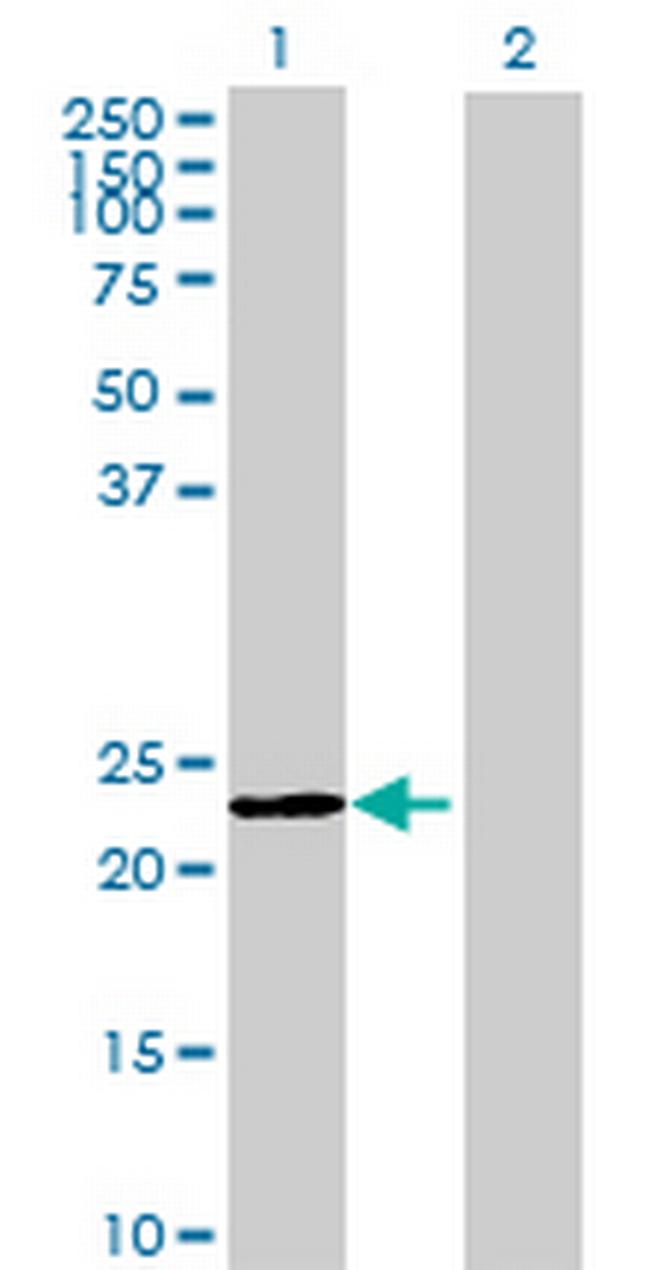 RP5-821D11.2 Antibody in Western Blot (WB)