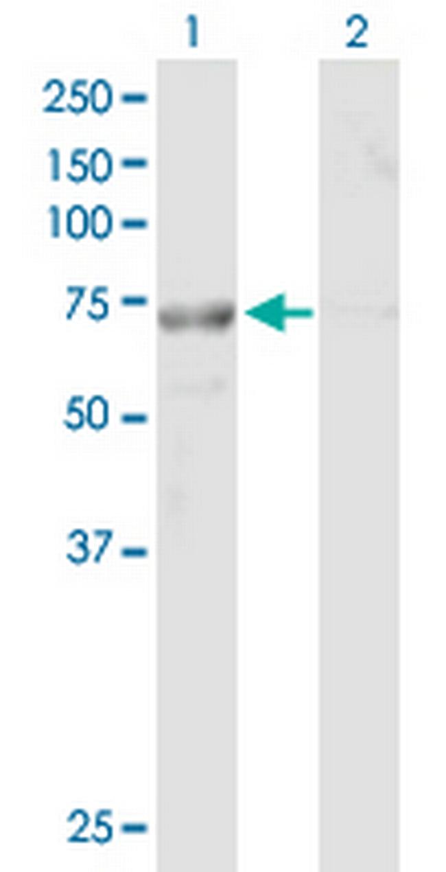 FLJ30990 Antibody in Western Blot (WB)