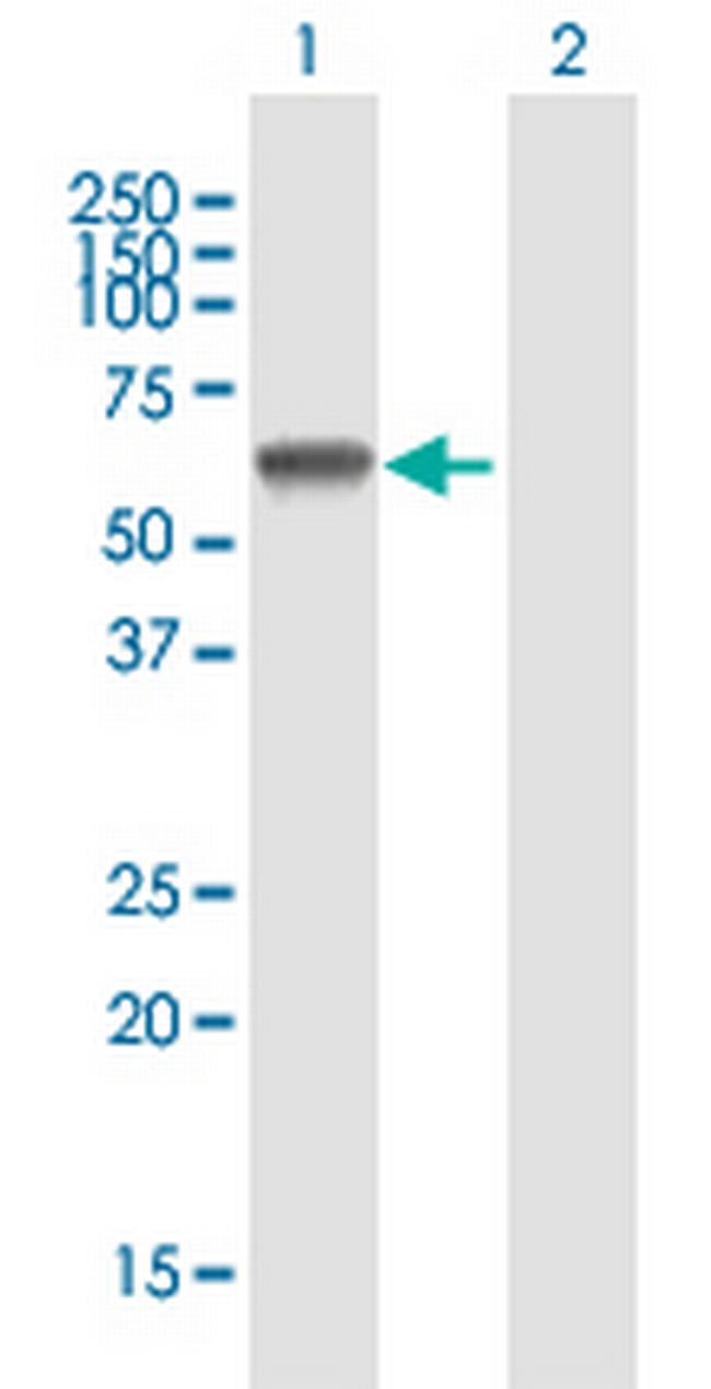 IRX2 Antibody in Western Blot (WB)