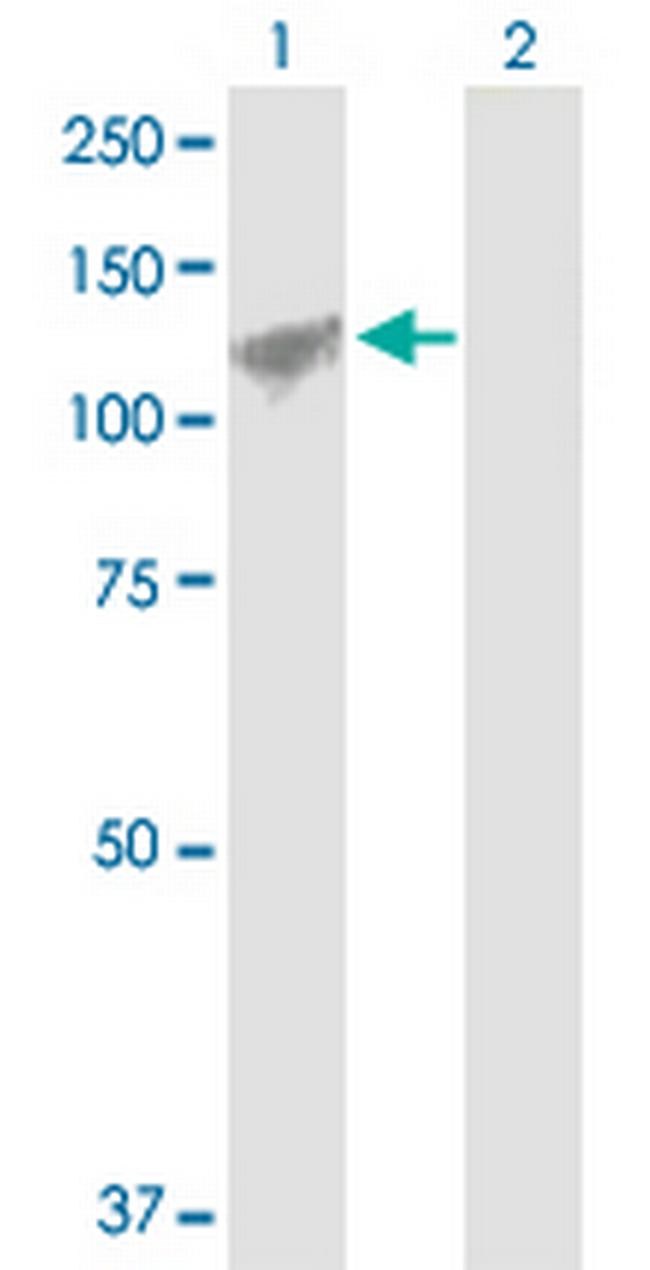 AMOTL1 Antibody in Western Blot (WB)