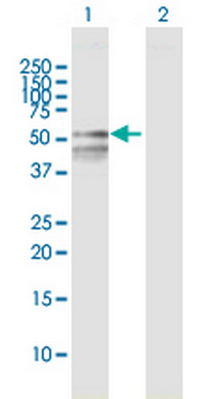 RBMY1F Antibody in Western Blot (WB)