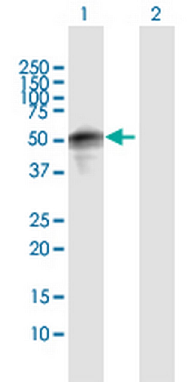 SPRED1 Antibody in Western Blot (WB)