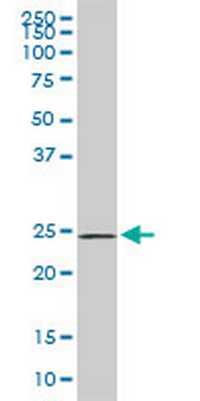 PHOSPHO1 Antibody in Western Blot (WB)