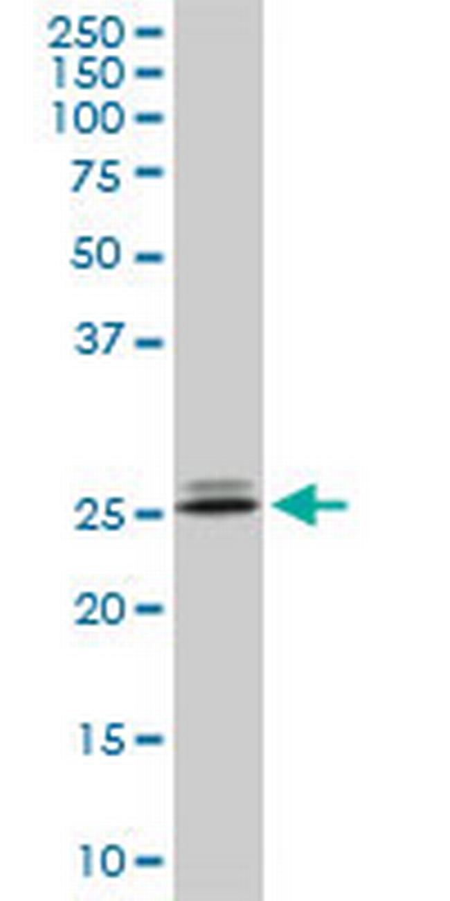 PHOSPHO1 Antibody in Western Blot (WB)