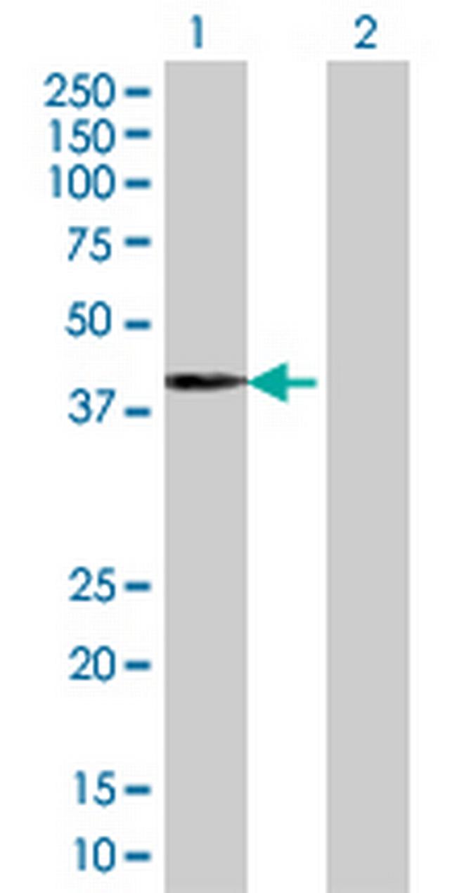 ZNF550 Antibody in Western Blot (WB)