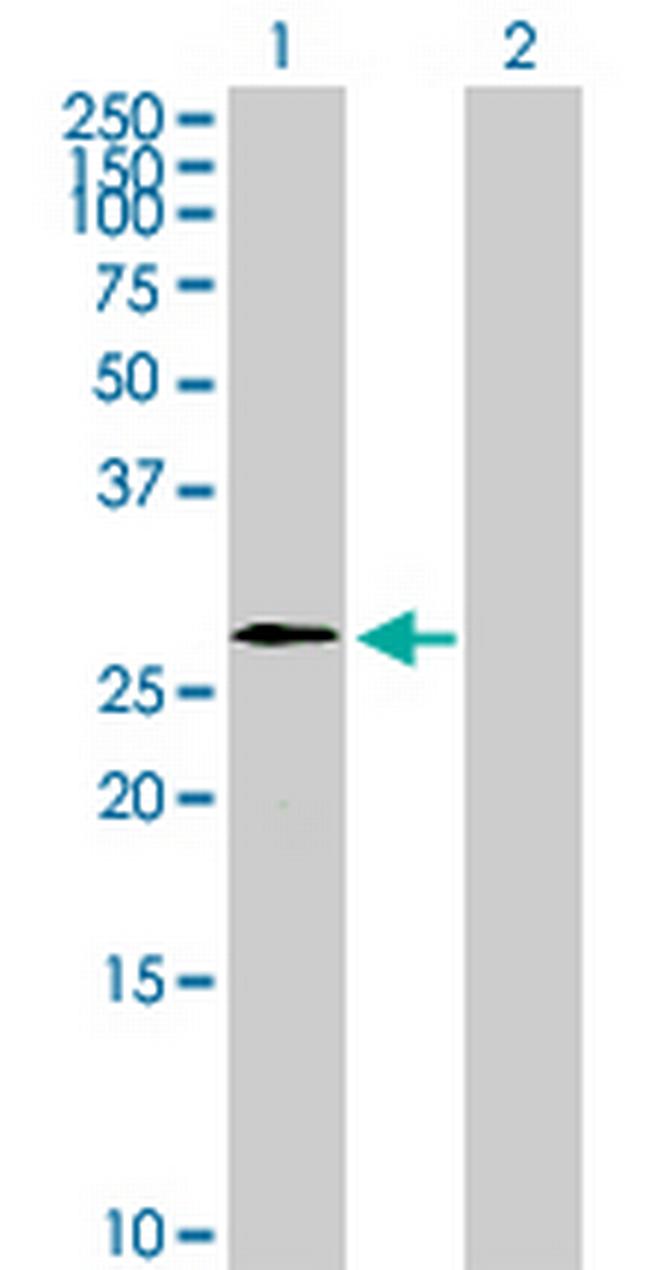 WBP2NL Antibody in Western Blot (WB)