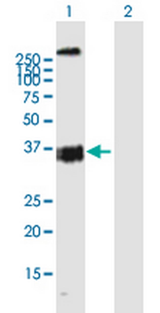 OXER1 Antibody in Western Blot (WB)