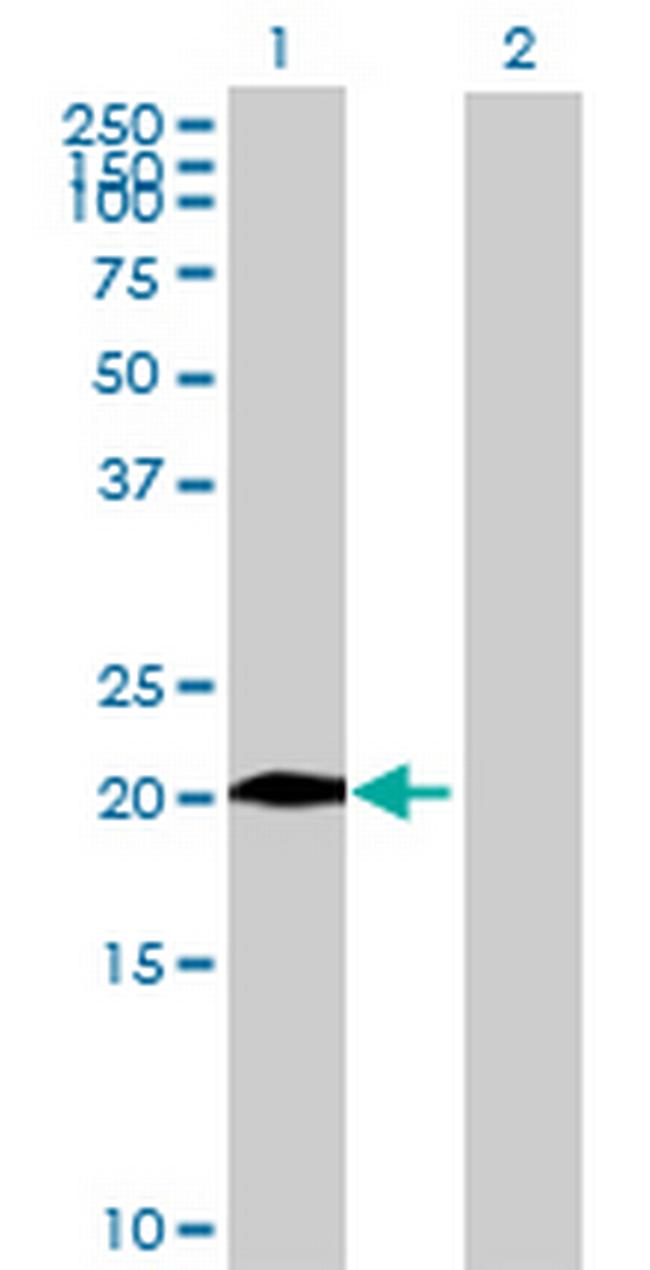 CHST13 Antibody in Western Blot (WB)