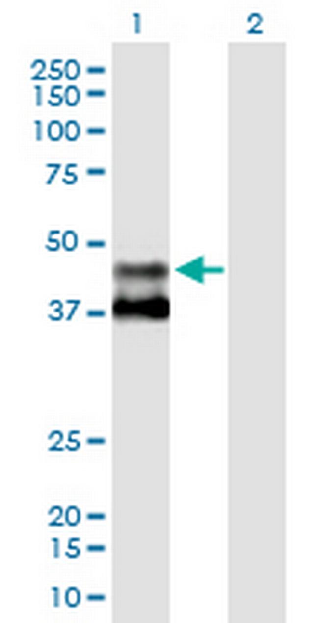 MMAA Antibody in Western Blot (WB)