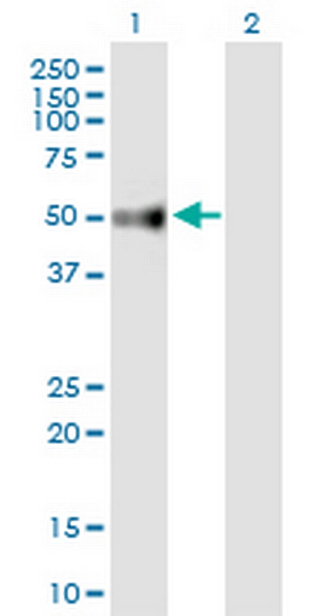 UGT3A2 Antibody in Western Blot (WB)