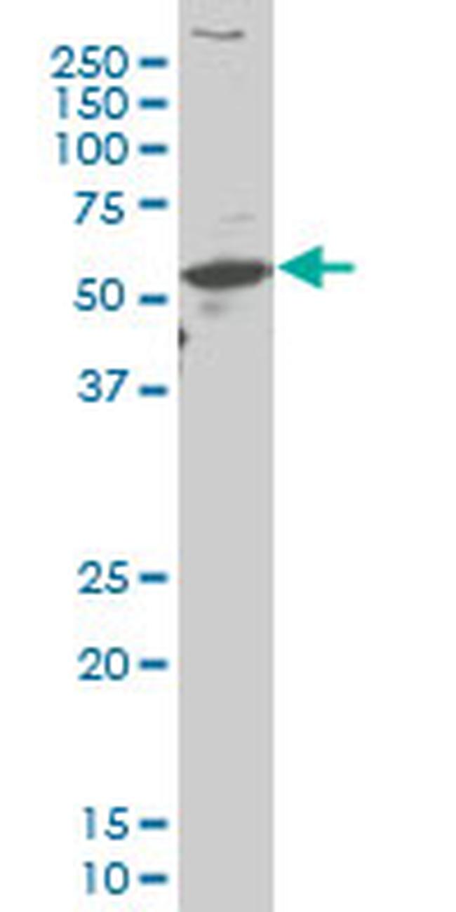 ARX Antibody in Western Blot (WB)