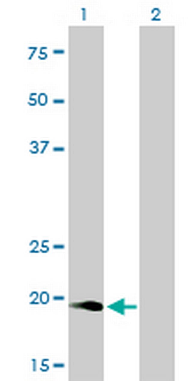 NUDT10 Antibody in Western Blot (WB)