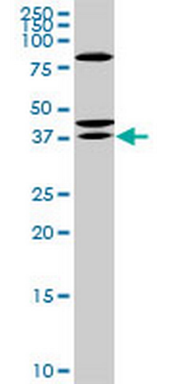 RDHE2 Antibody in Western Blot (WB)