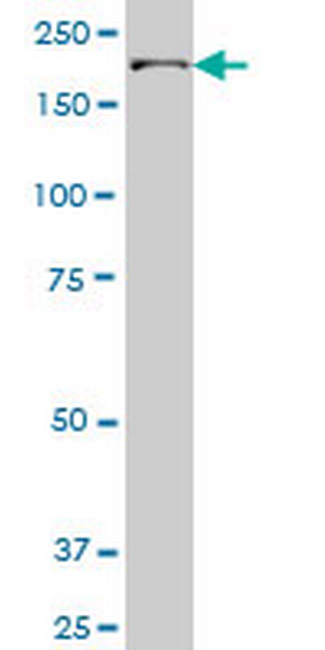 UBR1 Antibody in Western Blot (WB)