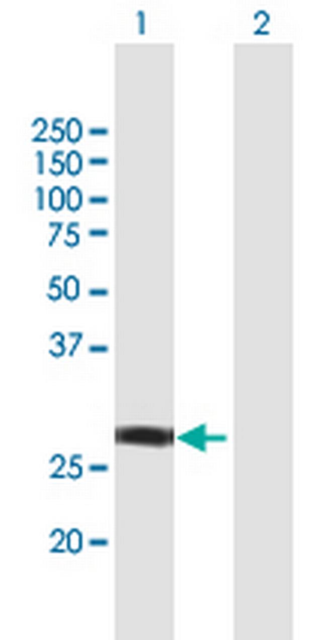 NSMCE1 Antibody in Western Blot (WB)