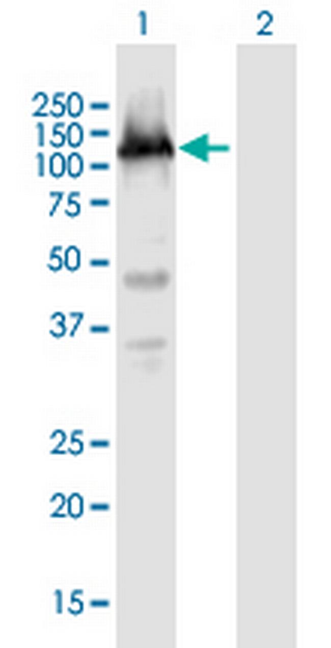 TET3 Antibody in Western Blot (WB)