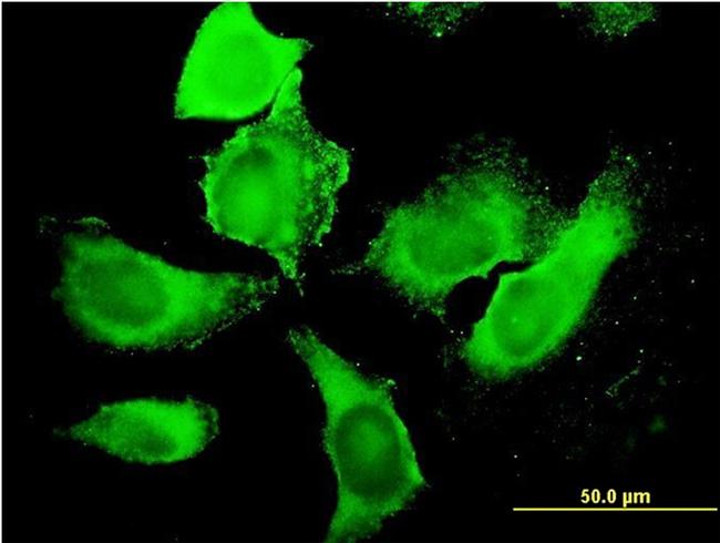 PIP5K3 Antibody in Immunocytochemistry (ICC/IF)