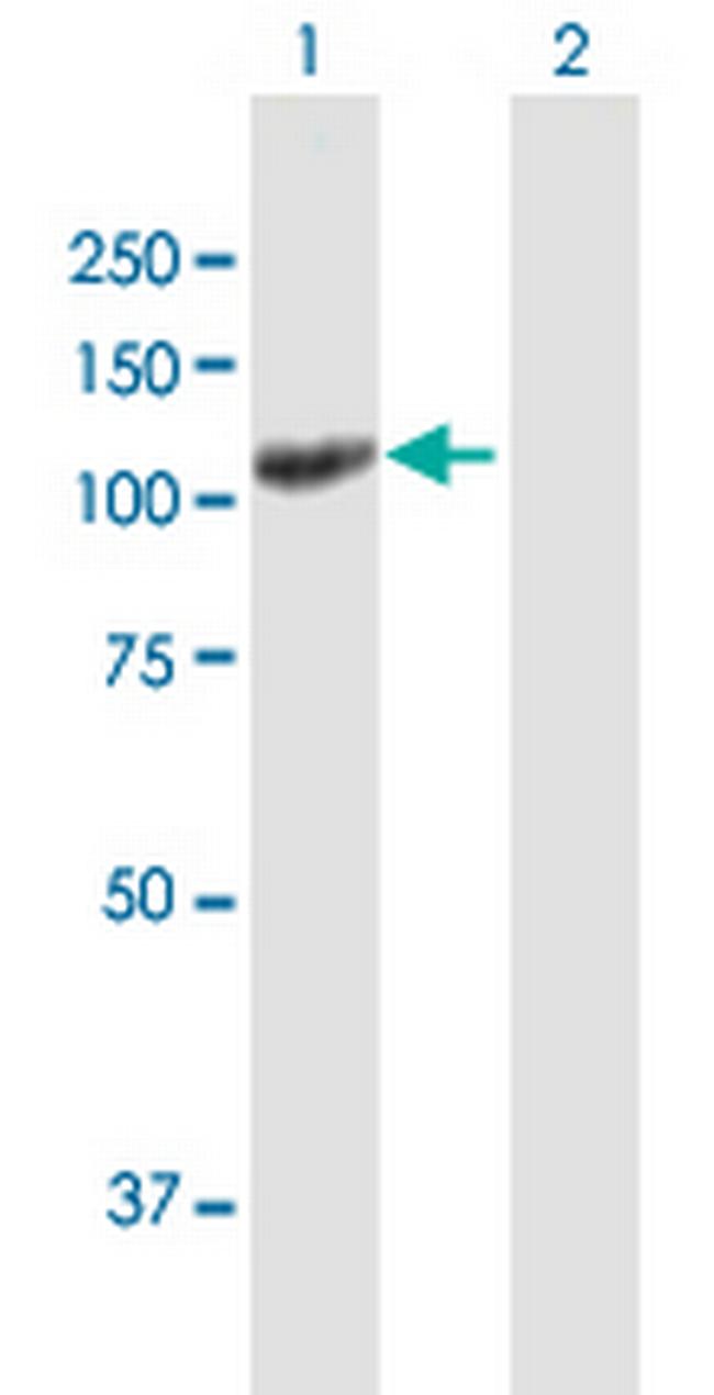 UNC13D Antibody in Western Blot (WB)