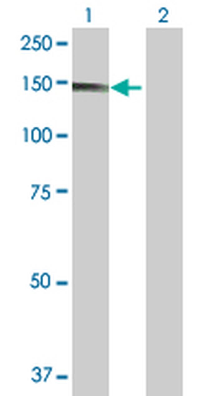 UNC13D Antibody in Western Blot (WB)