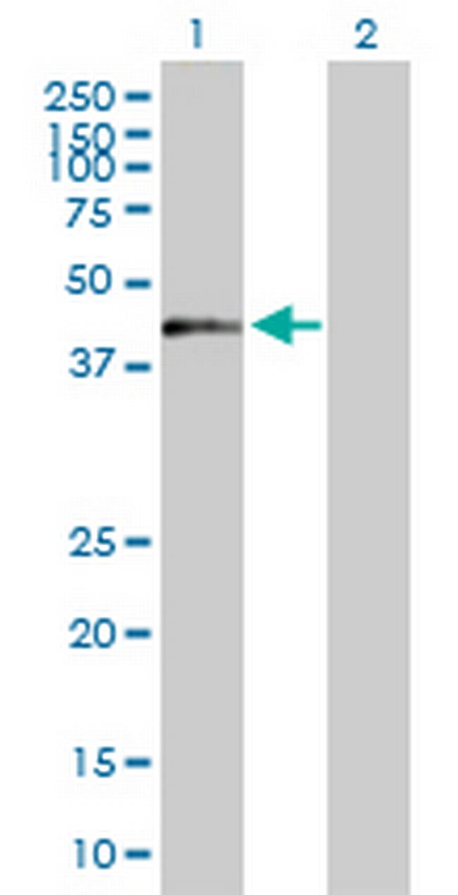 ZNF584 Antibody in Western Blot (WB)