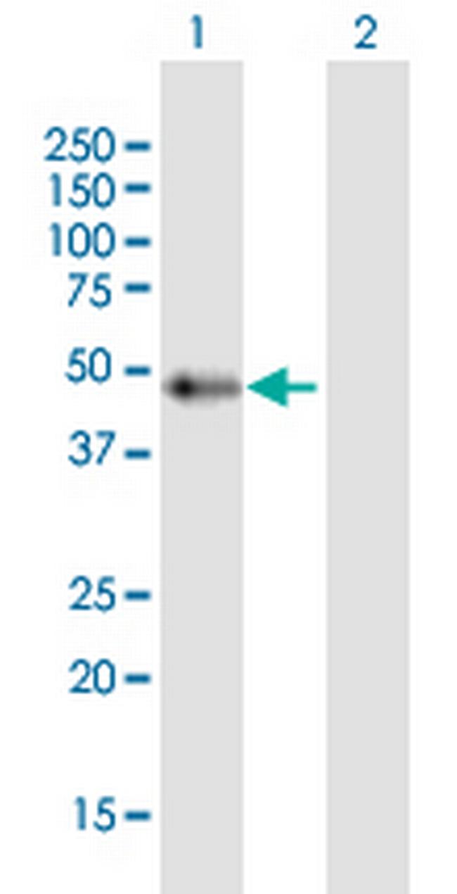 C9orf72 Antibody in Western Blot (WB)