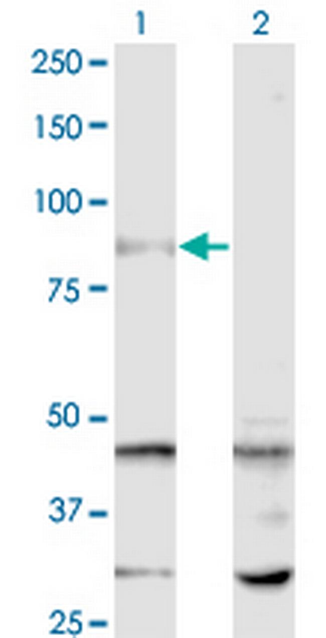 SENP5 Antibody in Western Blot (WB)