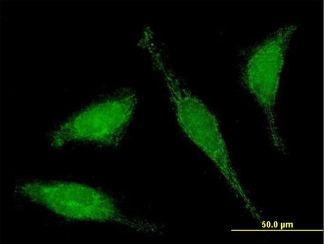 C6ORF206 Antibody in Immunocytochemistry (ICC/IF)