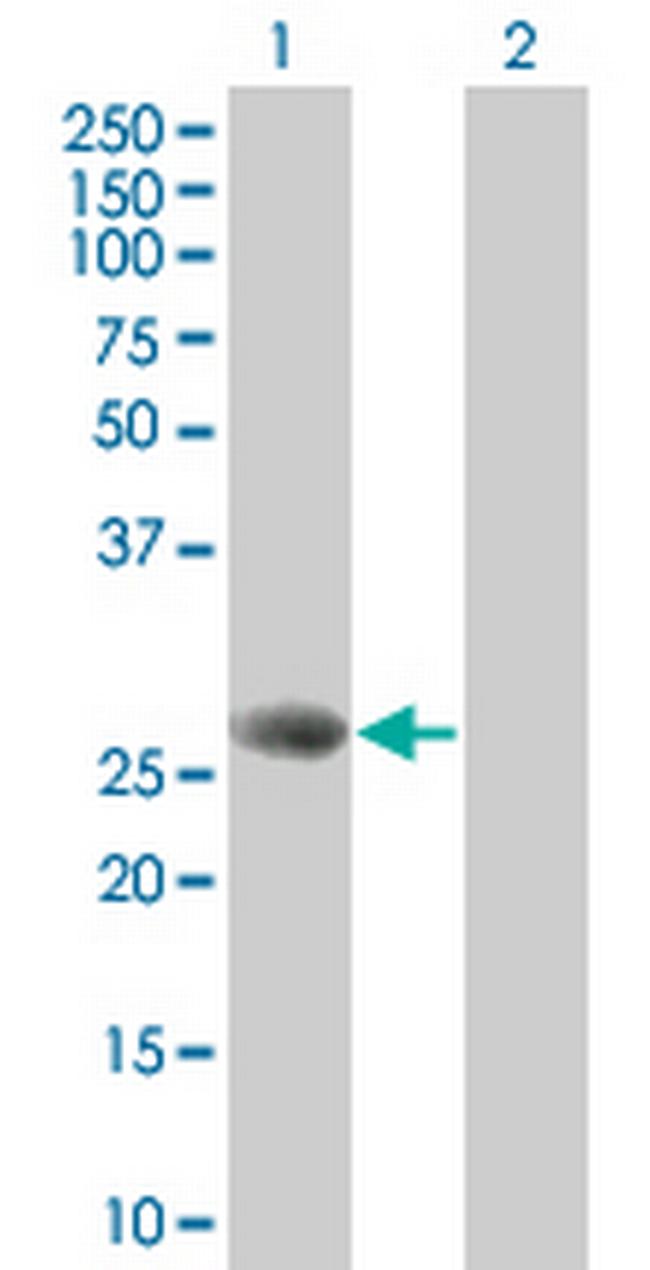 STXBP4 Antibody in Western Blot (WB)