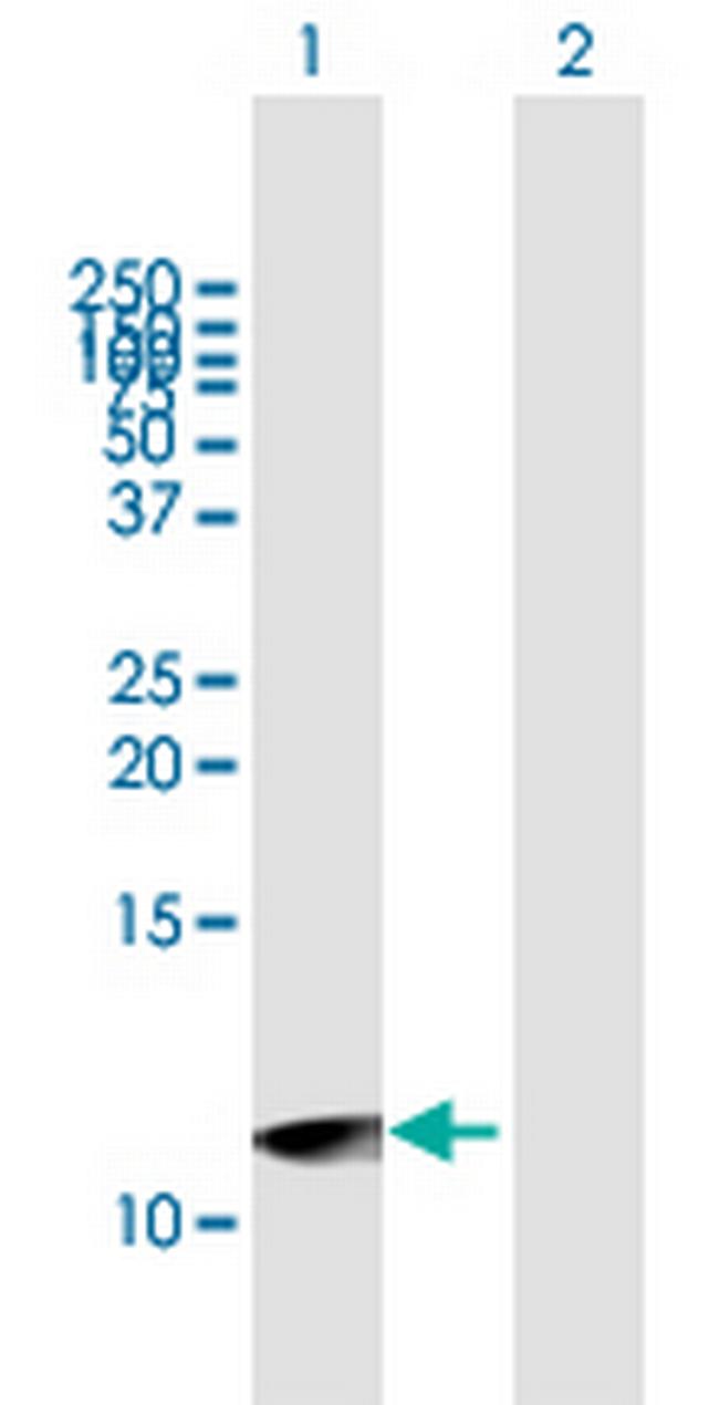 UTS2D Antibody in Western Blot (WB)