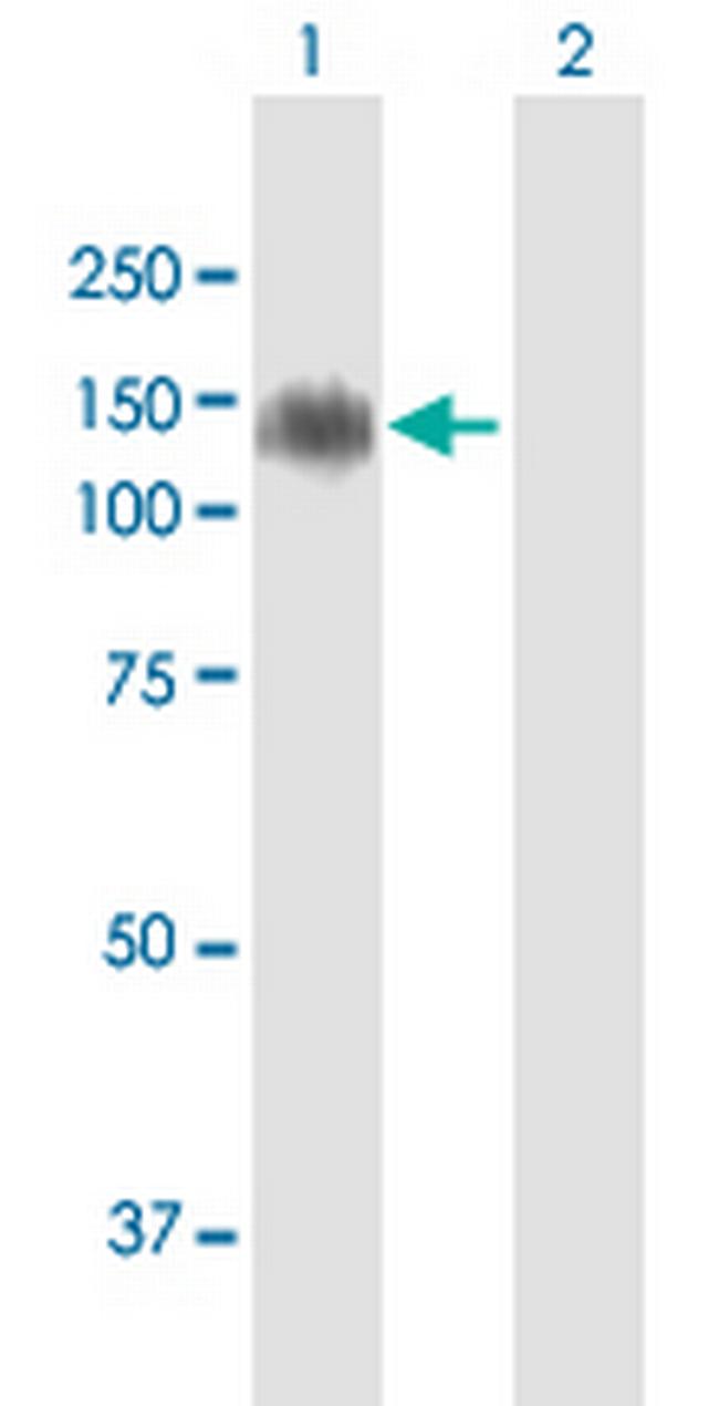 MDGA1 Antibody in Western Blot (WB)