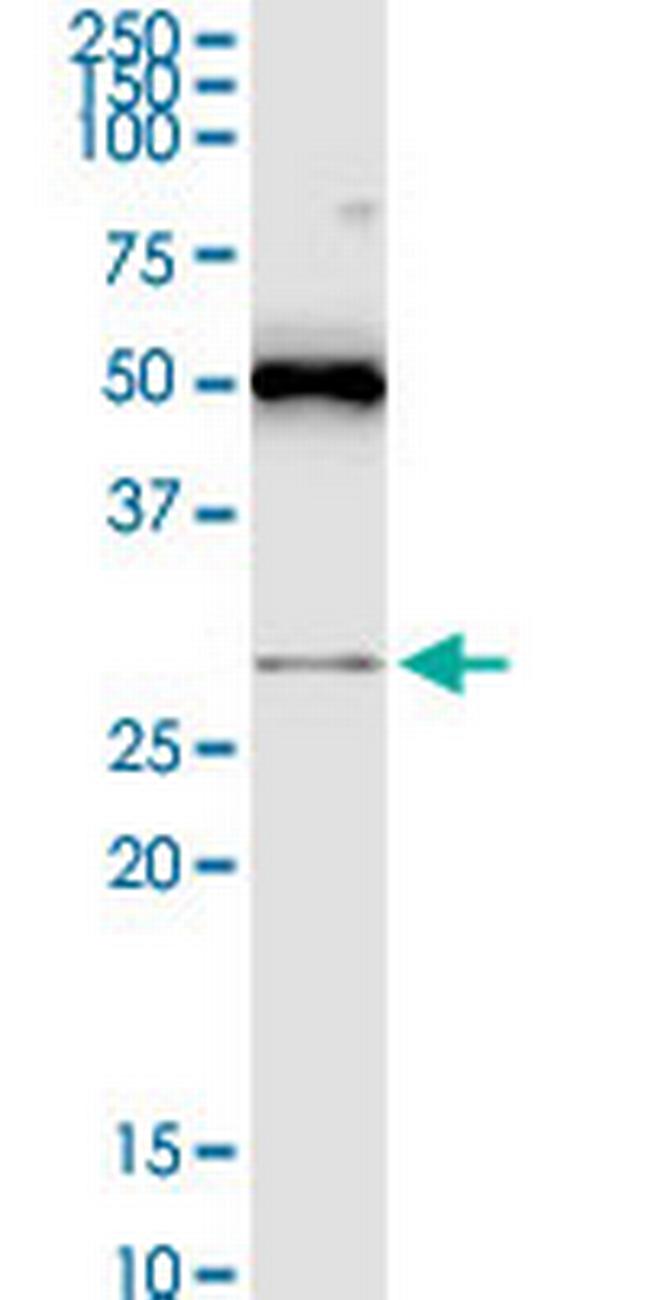 RASSF3 Antibody in Western Blot (WB)