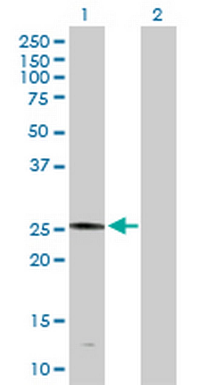 PLA2G4D Antibody in Western Blot (WB)