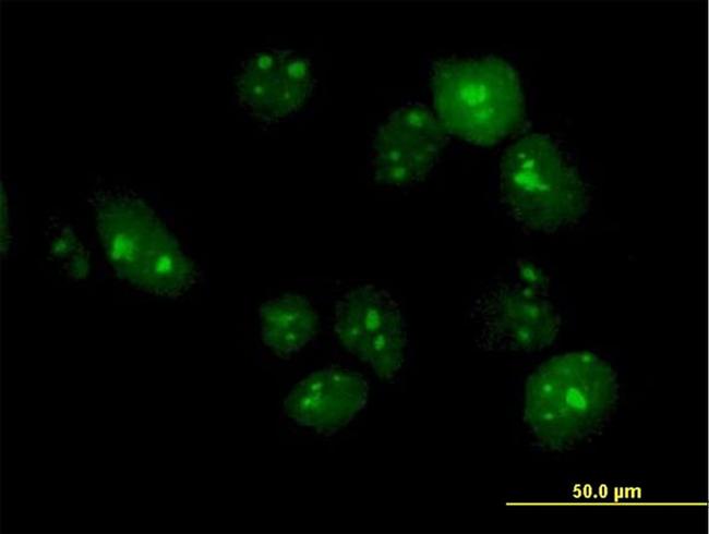 TTLL6 Antibody in Immunocytochemistry (ICC/IF)