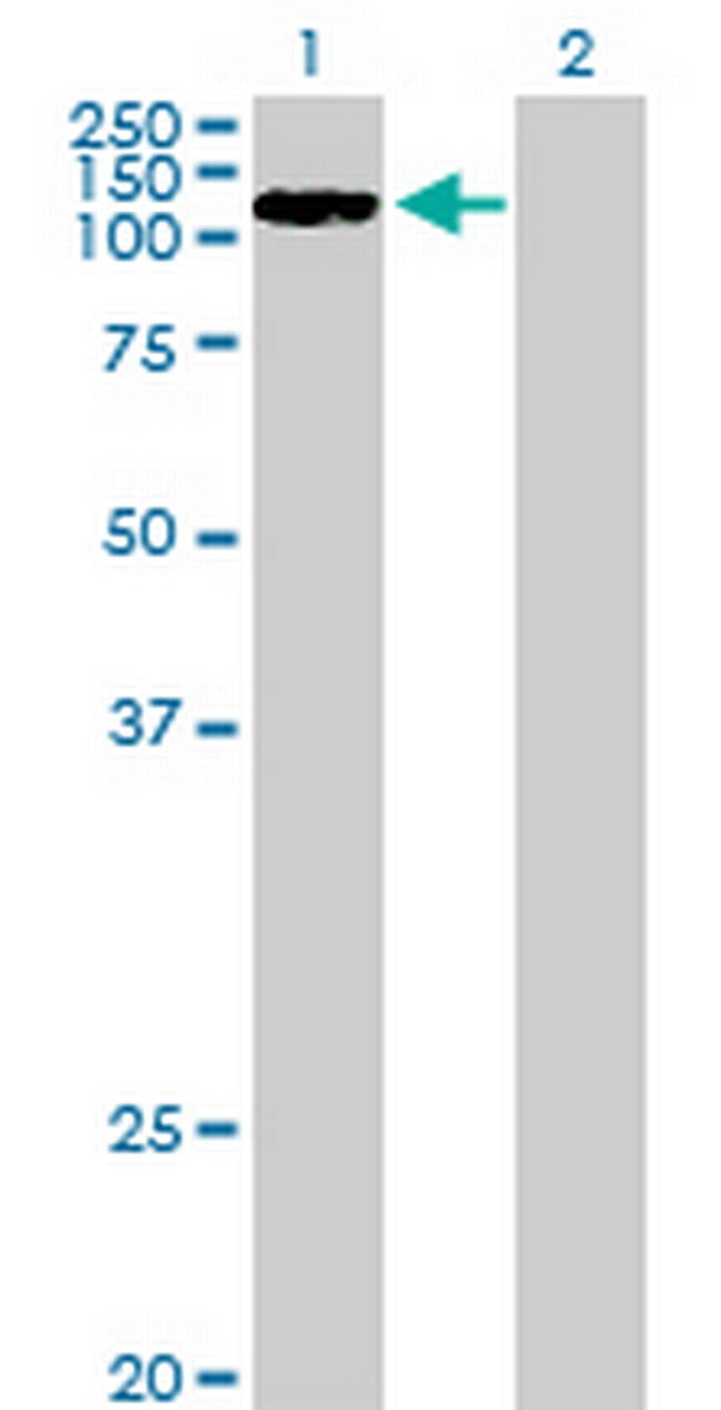 CCDC66 Antibody in Western Blot (WB)