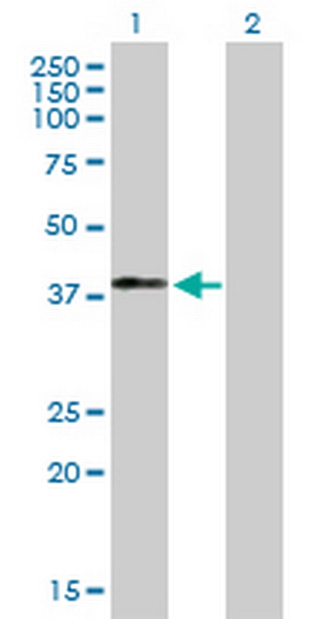 MAGEB18 Antibody in Western Blot (WB)