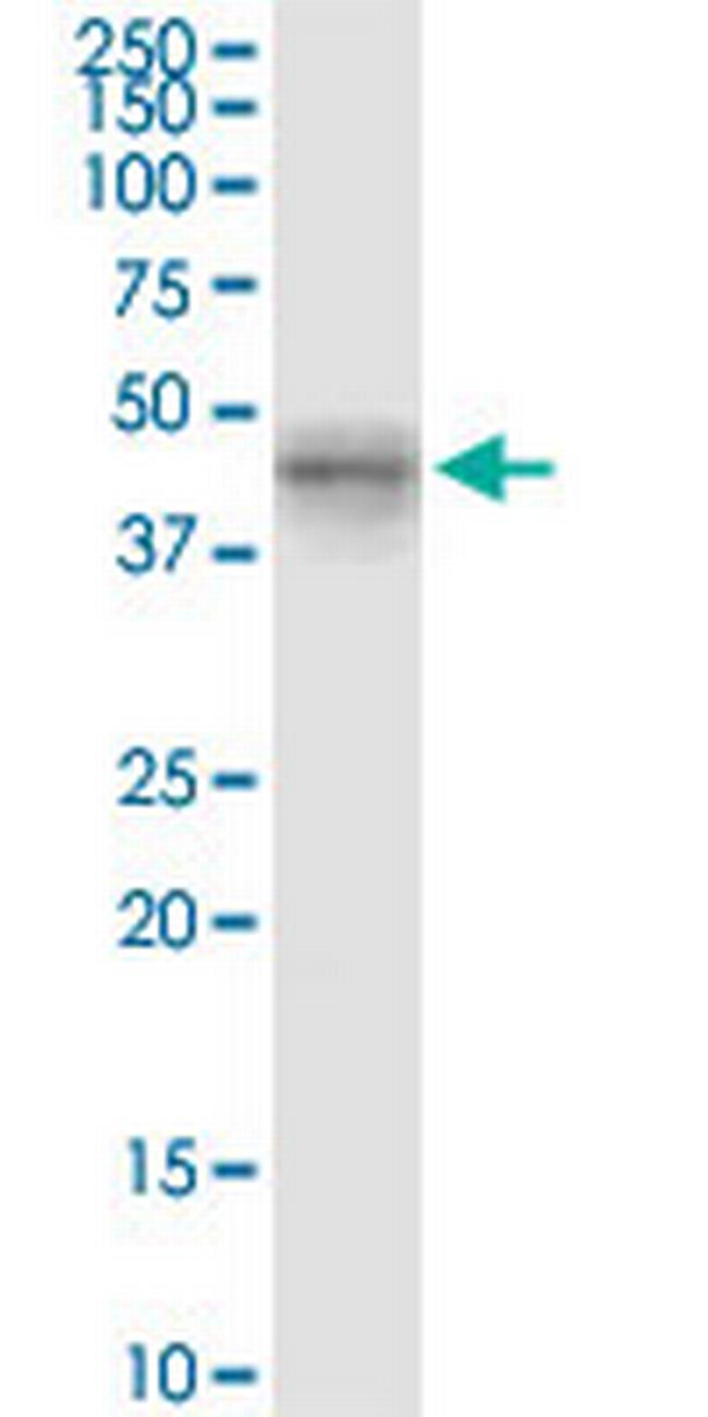 MYLK4 Antibody in Western Blot (WB)