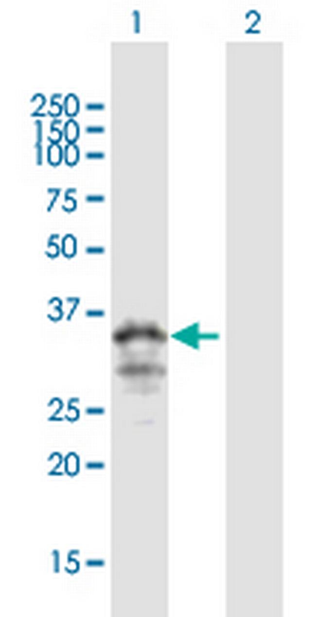 MOGAT3 Antibody in Western Blot (WB)