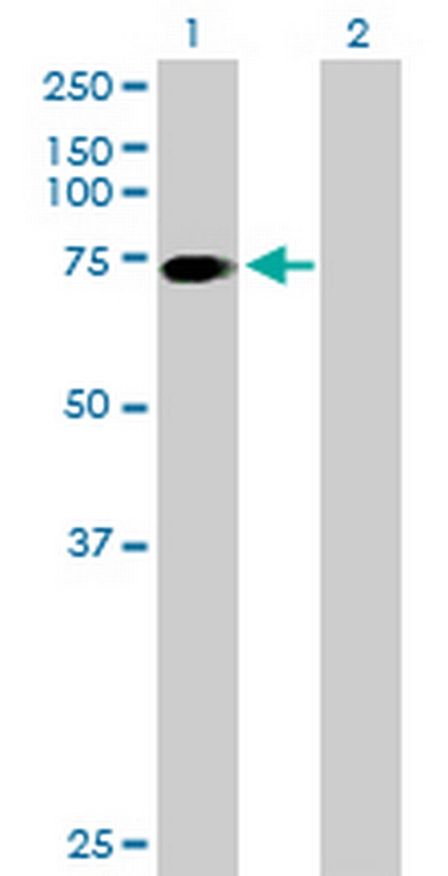 SLC6A17 Antibody in Western Blot (WB)