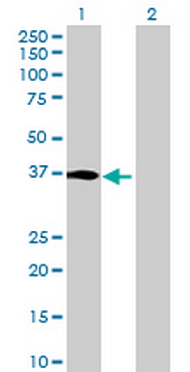 C6orf71 Antibody in Western Blot (WB)